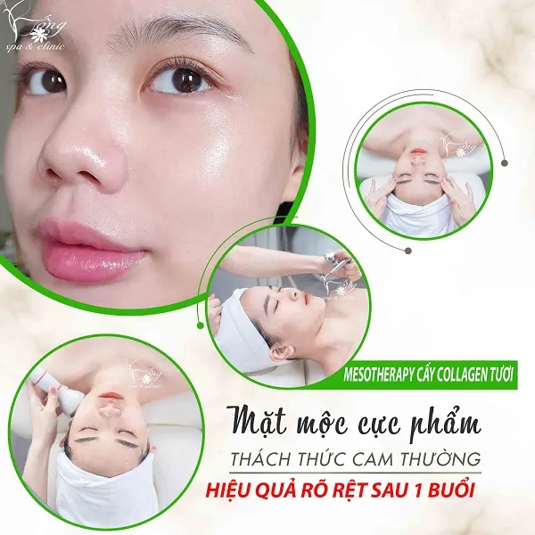 Bống Spa – Spa trị mụn làm đẹp uy tín tại Q.Tân Bình Tphcm