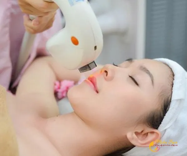 Midu Spa – Địa chỉ triệt râu vĩnh viễn uy tín Thủ Đức