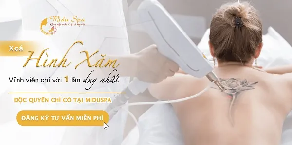 Midu Spa – Địa chỉ xóa hình xăm uy tín quận 9