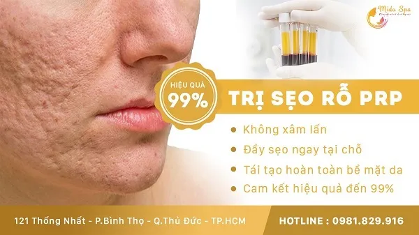 Midu Spa – Trung tâm điều trị da thẩm mỹ Thủ Đức